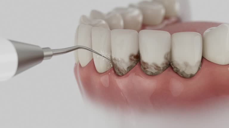 Reliable Tooth Extraction contractor in Mojave, CA by Smile Center Dentistry